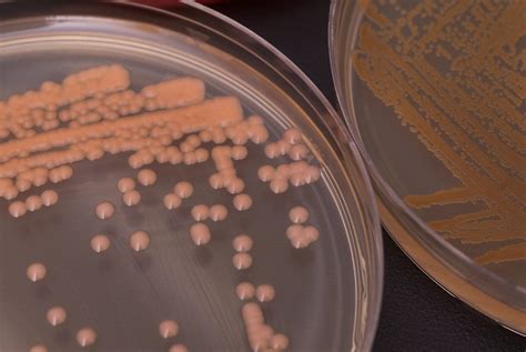 Demonstrating Stability in Bioburden Numbers and Types | Nelson Labs