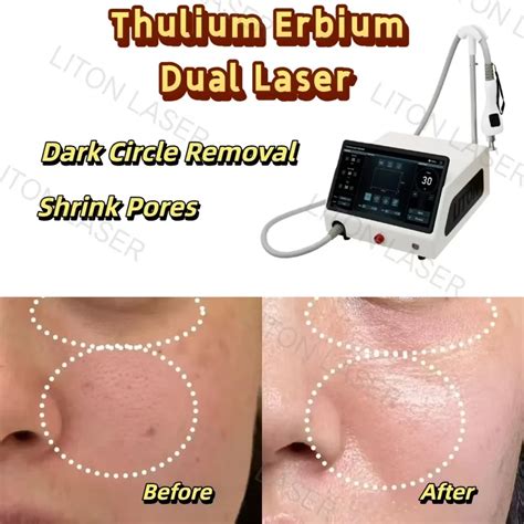 Fractional 1927nm Thulium Laser Facial Aesthetics Device