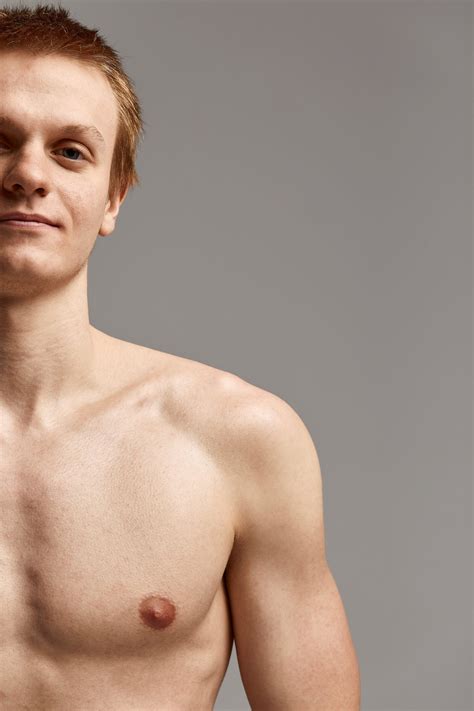 Gynecomastia Surgery: Achieve a Sculpted Male Chest Today