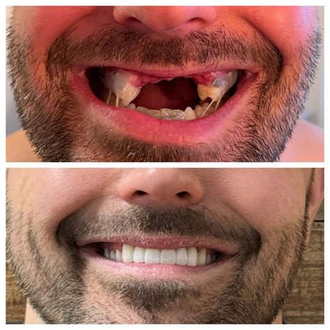 Dental Success Stories | Omni Dental Shadyside