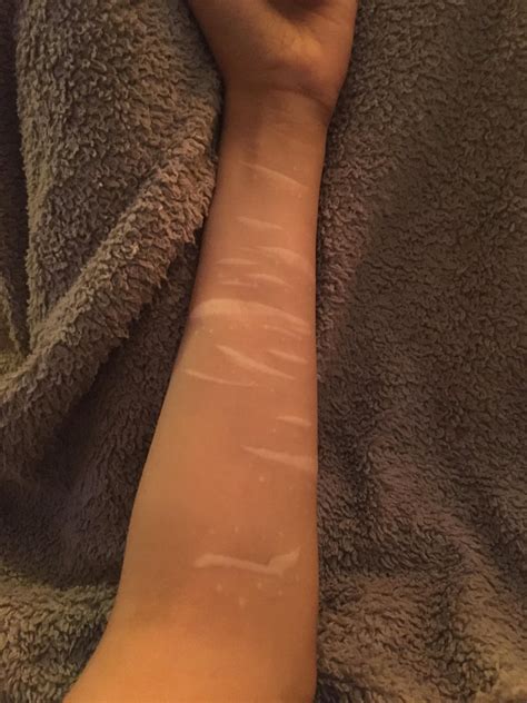 Self Harm Scars Cover Up Ideas : r/TattooDesigns