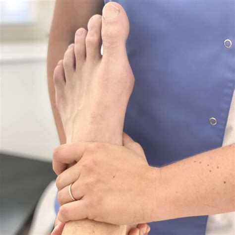 Le syndrome de Mueller-Weiss : cette pathologie rare qui mieux connue grâce à Rafael Nadal ...