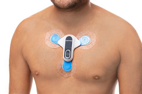 Cardiac Loop Recorder Implantable ICM Loop Recorder For Dogs