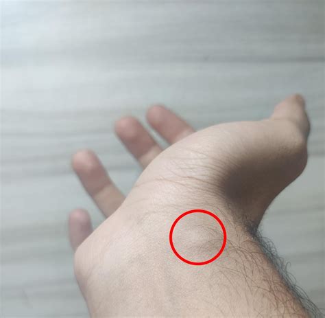 I had this small bump on my wrist for a long time now, can anyone tell ...