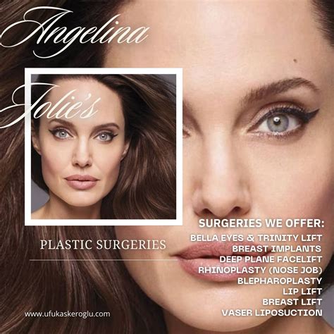 Angelina Jolie Plastic Surgeon - Ufuk Askeroğlu