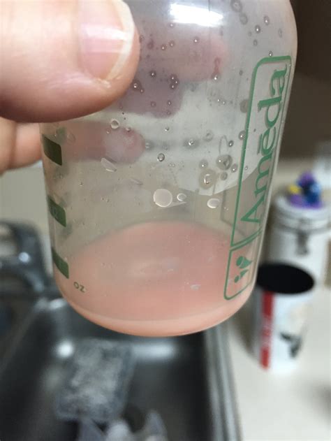 Blood In Breast Milk | Renew Physical Therapy