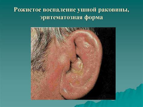 Хирургические инфекции - презентация онлайн