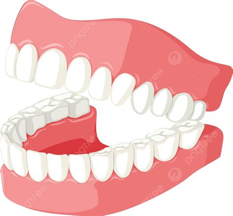 What Is Teeth Clipping at Gail Odom blog