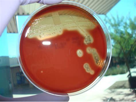 Types Of Hemolysis In Blood Agar at Phillip Pusey blog