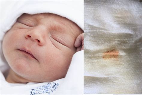 Pipí naranja en el pañal de mi recién nacido ¿qué son esas manchas ...