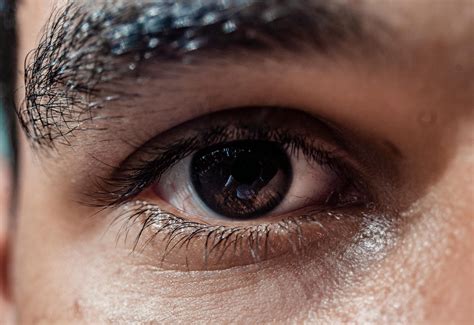 Glaucoma and Family History: Why Screening Matters - Glaucoma Treatment in Karachi