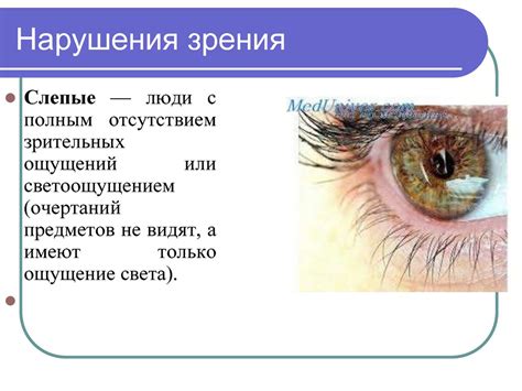 Сенсорные нарушения, их коррекция и реабилитация (речевые, зрительные и ...