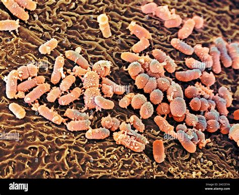 Bacteria in the nose. Coloured scanning electron micrograph (SEM) of ...