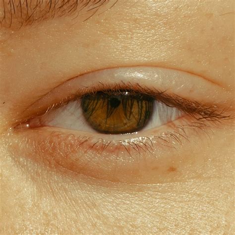 Parpadeo Involuntario: Causas y Soluciones | Optica Naranjo