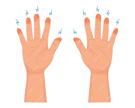 Premium Vector | Frozen hands in different stages. medical frostbite. stages of frostbite of ...