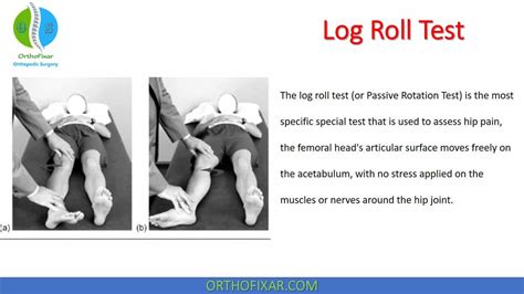 Log Roll Test For Hip Pain Diagnosis Explained Easily | OrthoFixar