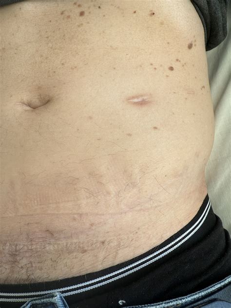 PACES AID | High-Yield MRCP PACES Revision Resource