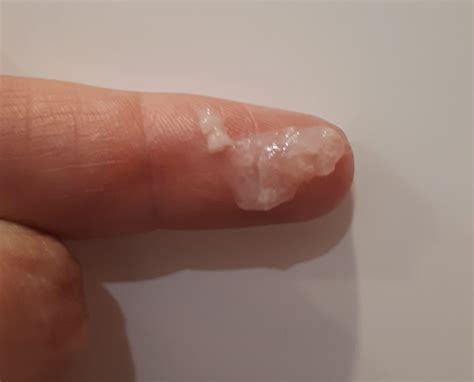 What is fertile mucous? | natural fertility medicine | Point Specifics