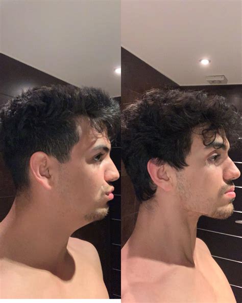 What Is Tongue Chewing Exercise (MEWING) and How To Do it For A Stronger Jawline