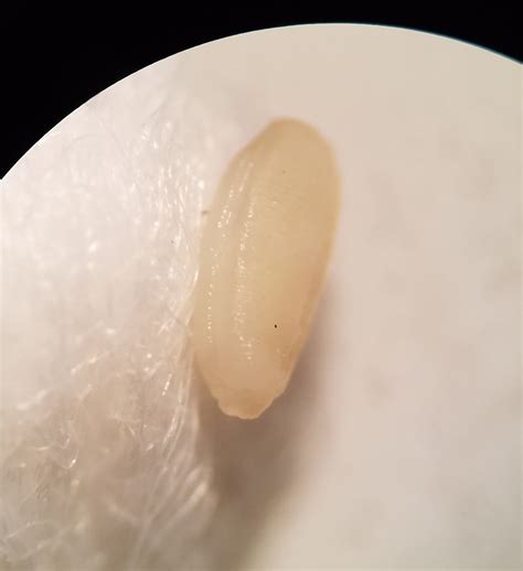 Tapeworm Segments