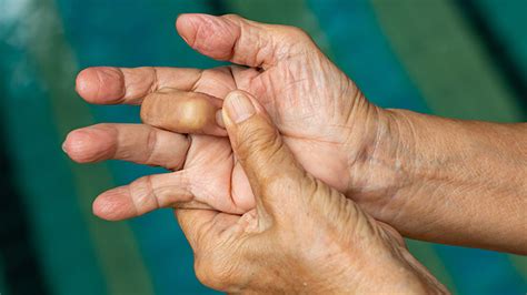7 Best Trigger Finger Exercises to Relieve Pain - GoodRx