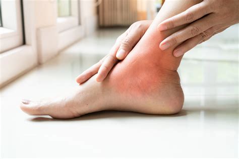 Arthritis | Podiatry Center of New Jersey