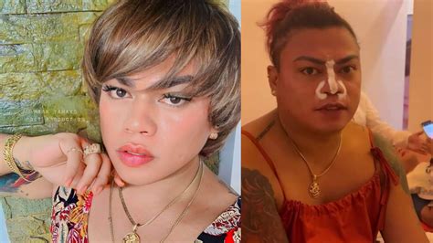 Itsura ni Brenda Mage matapos magparetoke ng ilong viral na