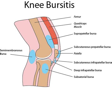 Infrapatellar bursitis causes, symptoms, diagnosis & treatment