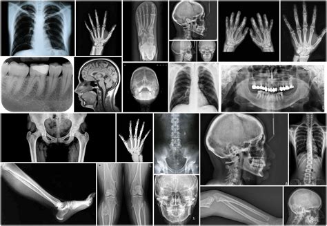 X Ray Files Instant Downloads. Printable Tags Pages Paper Craft - Etsy