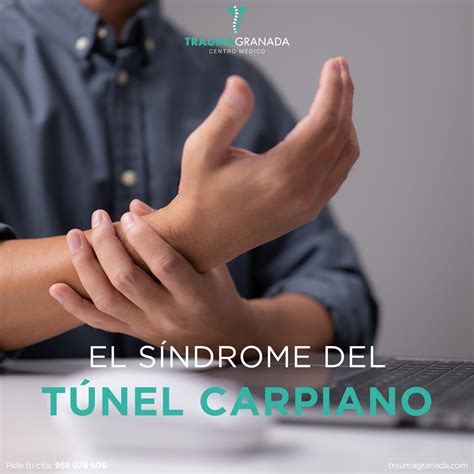 El síndrome del túnel carpiano - Trauma Granada