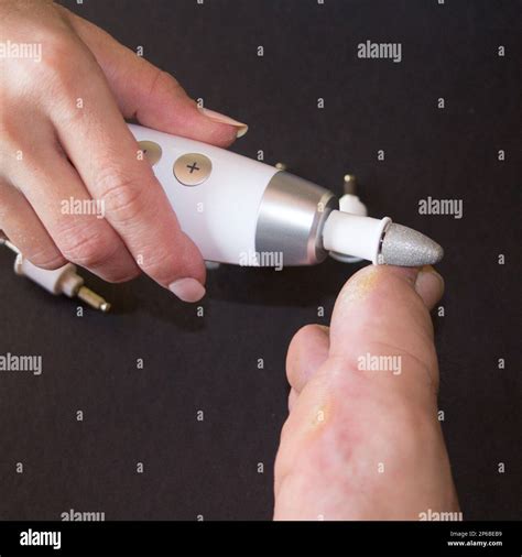 Image of a mini drill used by a beautician as she removes dead skin from a big toe. Calluses ...