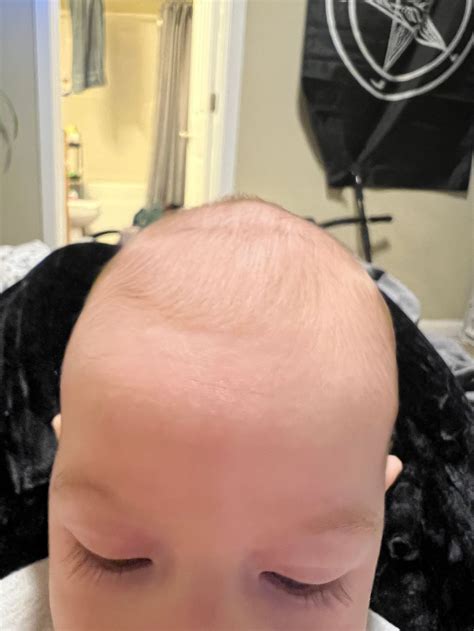 sunken in soft spot?? | BabyCenter