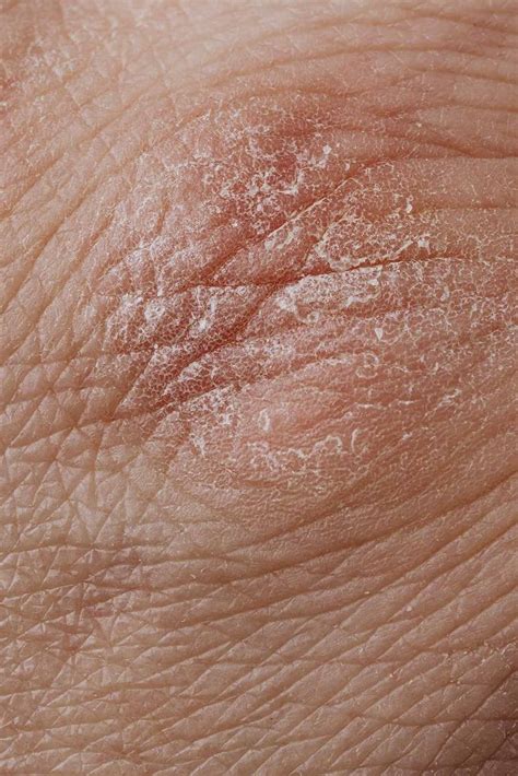 Is Your Skin Dry Or Dehydrated? There’s A Difference. – Snow Fox Skincare