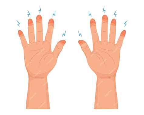 Premium Vector | Frozen hands in different stages. medical frostbite. stages of frostbite of ...