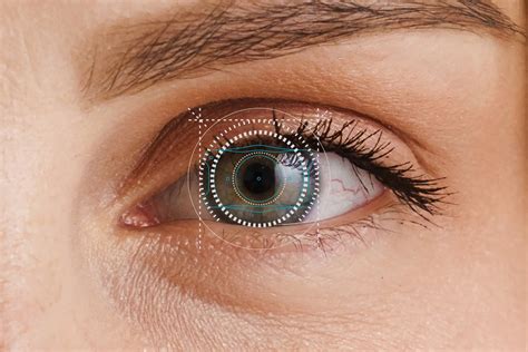 What You Should Know About Refractive Lens Exchange (RLE) | Optimax