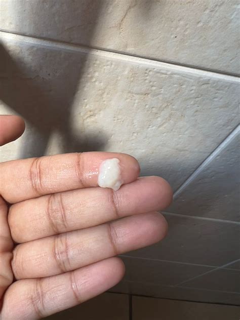 Early Pregnancy Discharge Mucus