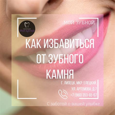 Мой Зубной | ВКонтакте