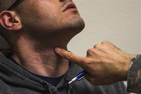 Eliminate Razor Bumps on Your Nexk | EpilatorJudge.com