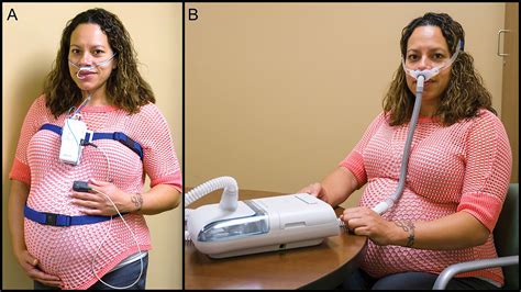 Obstructive Sleep Apnea in Pregnancy: Early Lessons from our Sleep ...