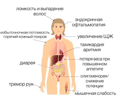 Диффузный токсический зоб | Городская клиническая больница им. Ф.И ...