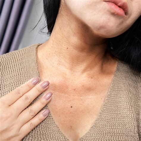 How To Repair And Smooth Neck Wrinkles For A More Youthful Look In 2024, According To A Skincare ...