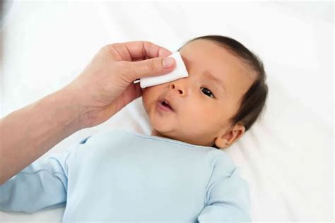 How to Unblock Infant Tear Ducts in 7 Days