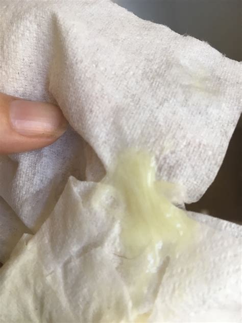 Is this part of my mucus plug it just discharge?