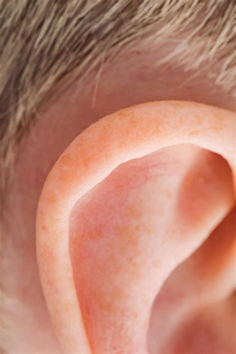 Itching Behind Ears – Causes, Rash & How to Treat It