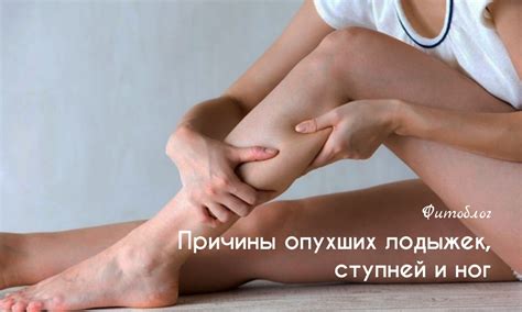Отек ног: причины отеков, методы лечения и профилактика - FitoBlog