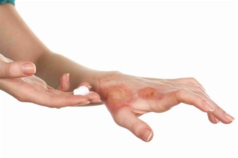 Contact Dermatitis | ClairéDerma