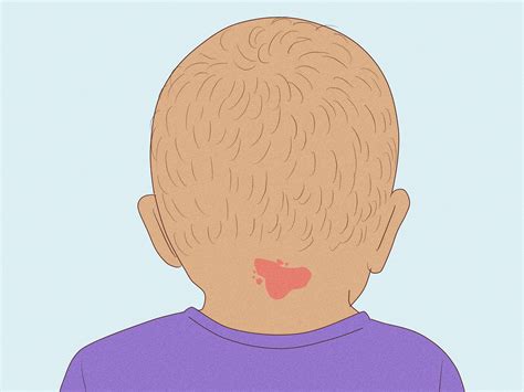 Angel Kiss Birthmark Meaning: Spiritual Interpretations