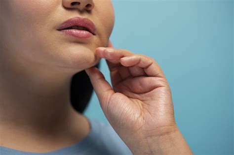 Chin Acne in Adults: Root Causes Women Miss