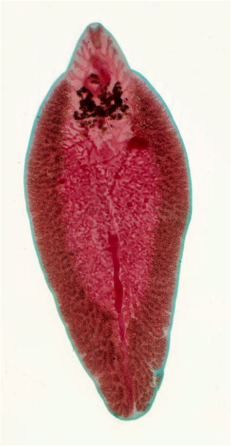 Fasciola Hepatica