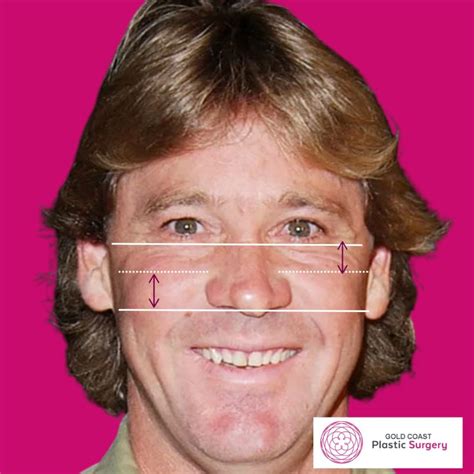 High vs Low Cheekbones: How do you know?